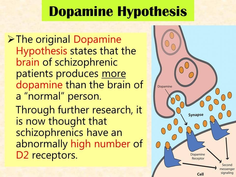 Image result for Schizophrenia neurotransmitter dopamine